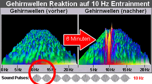 Gehirnwellen Stimulation